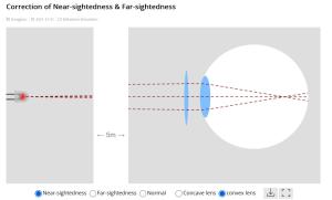 Cover: Correction of Near-sightedness & Far-sightedness - JavaLab