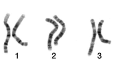 Cover: Karyogramm - Chromosomen ordnen
